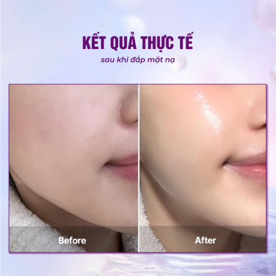 Mặt nạ sinh học BESKINATY Gold Bio Mask chống lão hóa phục hồi da hiệu quả  Hàn Quốc