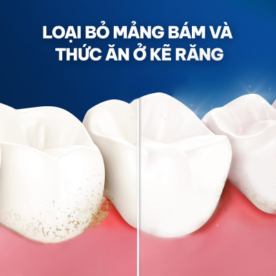 Chỉ Nha Khoa Oral-B 50m