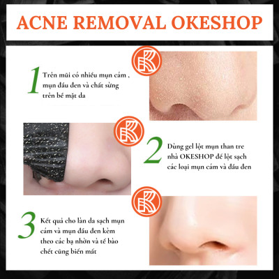 Gel Lột Mụn Than Tre Hoạt Tính OKESHOP 30ml - Giải Pháp Loại Bỏ Mụn Đầu Đen - Mụn Cám - Bạ Nhờn - Làm Sạch Sâu Và Thu Nhỏ Lỗ Chân Lông