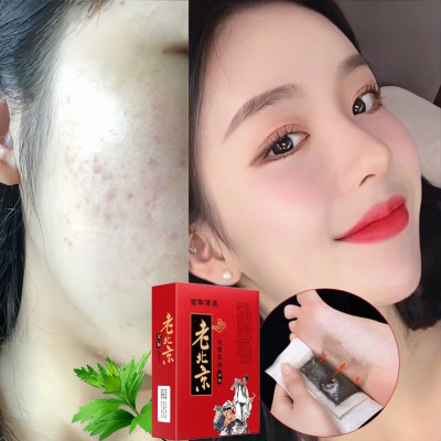 Hộp 50 Miếng Dán Ngải Cứu Thải Độc Chân Lão Bắc Kinh(Lao Beijing)