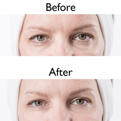 Kem dưỡng mắt từ khoáng biển chết - Eye Cream Kedma 50gr